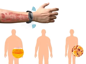 Ultrasonic Ultra-Tech Body Shape Wristband