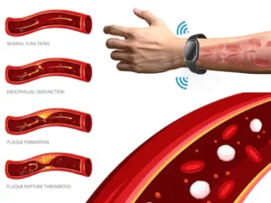 Ultrasonic Ultra-Tech Body Shape Wristband