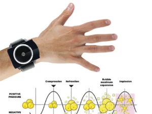 UltrasonicPro BodyShaping CelluLiquefy Wristband