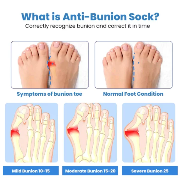 Κάλτσα υγειινής τσάντας Anti-Bunions