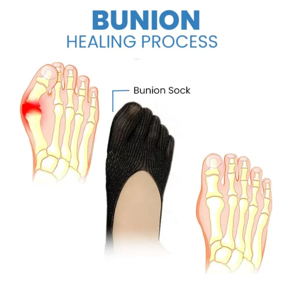 Soksi ya Afya ya Wingle Anti-Bunions