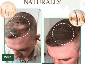 re:Fine™ Red Ginseng HairRe- Generation Spray