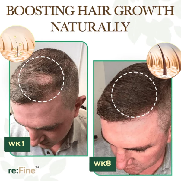 re:Fine™ Red Ginseng HairRe- Generation Spray