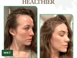 re:Fine™ Red Ginseng HairRe- Generation Spray