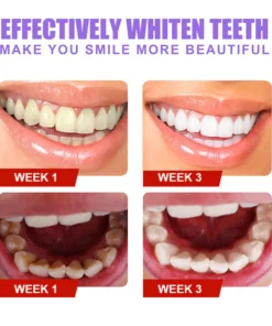 v34™ Dental Color Corrector - Dental Restoration Gel