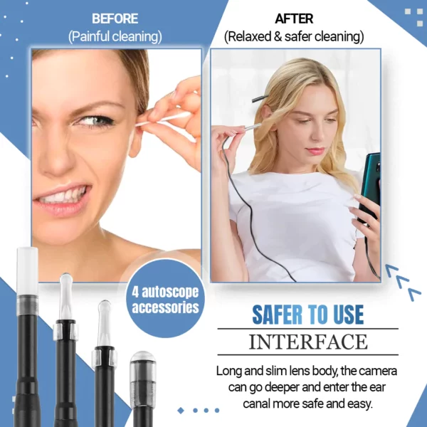 3-in-1 Smart Visual Ear Cleaner