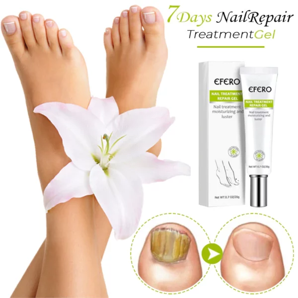 7Days Nail Repair TreatmentGel