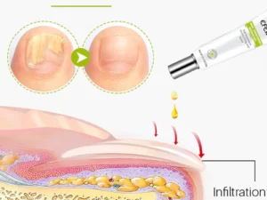 7Days NailRepair TreatmentGel