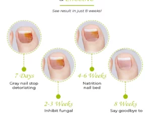 7Days NailRepair TreatmentGel