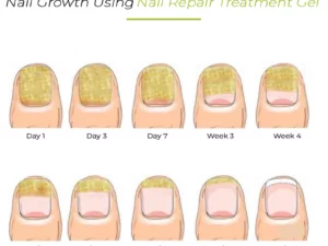 7Days NailRepair TreatmentGel