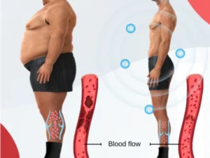 AMFIZZ™ Tourmaline Lymphvity Slimming Health Sock