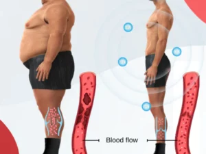 Akupunktur Slimming Socks