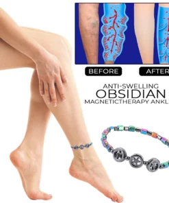 AntiSwelling Obsidian MagneticTherapy Anklet