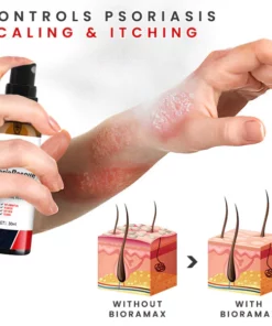 BIORAMAX Essence PsoriaRescue Treatment Spray