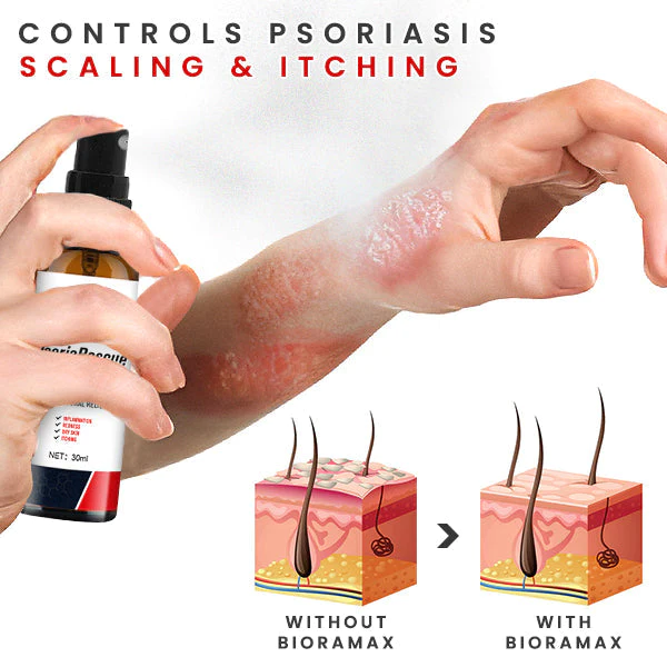 BIORAMAX Essence PsoriaRescue Spray per il trattamento