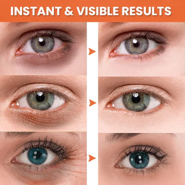 Crema de ojos antiarrugas con vitamina BeautyBright