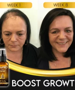 BioPRO Hair Growth Boosting Spray