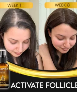 BioPRO Hair Growth Boosting Spray