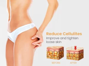 BurnFat™ Body Detox Nanotechnology Spray