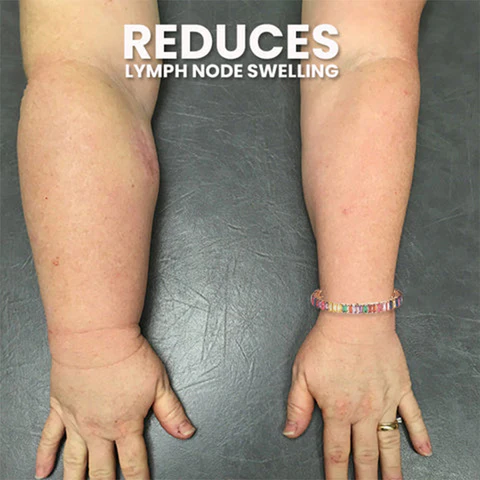 CrystalPower™ Lymph Drainage Magnetic Tourmaline Bracelet - Image 7