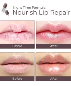 DEROL™ Lip Plumper Kit
