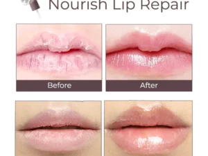 DEROL™ Lip Plumper Kit