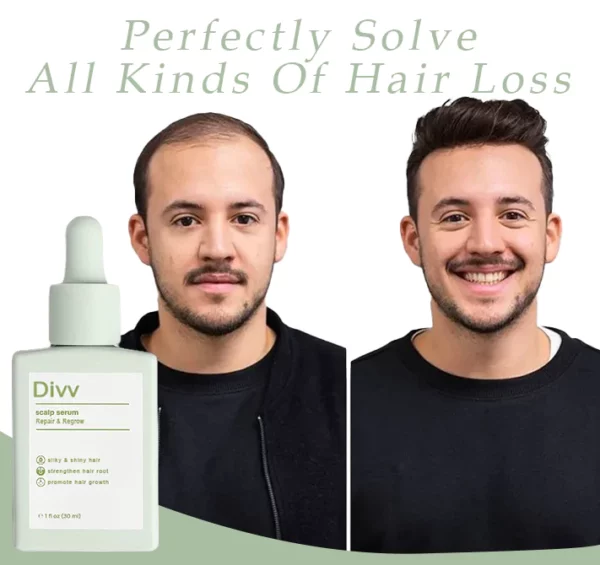 Divi™ Scalp Serum - Reparation och återväxt