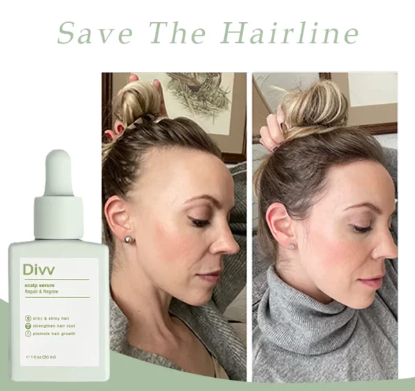 Divi™ Scalp Serum - අලුත්වැඩියා කිරීම සහ නැවත වර්ධනය කිරීම