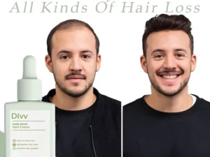 Divi™ Scalp Serum - Repair & Regrow