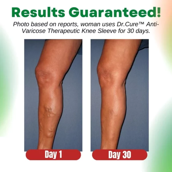 Dr.Cure™ Anti-Varicose Therapeutic Knee Sleeve