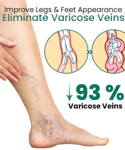 EL VITA Varicose Veins Treatment Soap