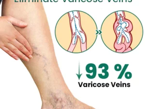 EL VITA Varicose Veins Treatment Soap