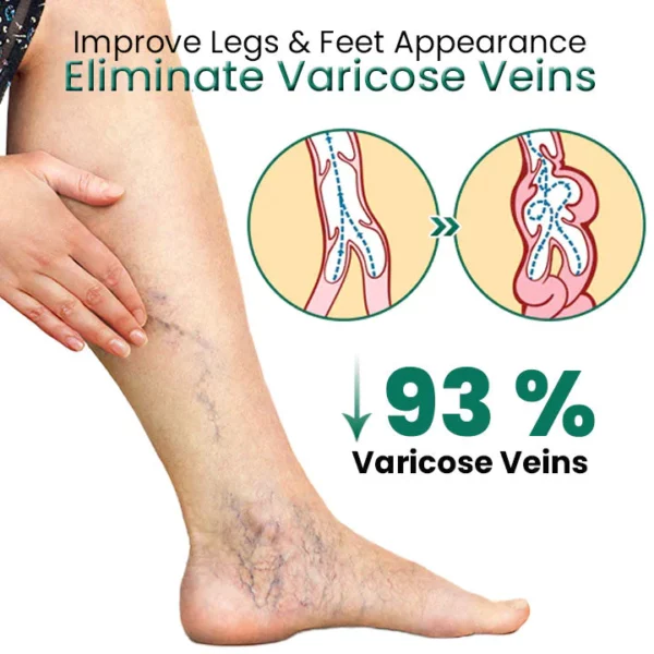 EL VITA Varicose Veins کا علاج کرنے والا صابن