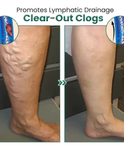 EL VITA Varicose Veins Treatment Soap