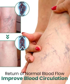 EL VITA Varicose Veins Treatment Soap