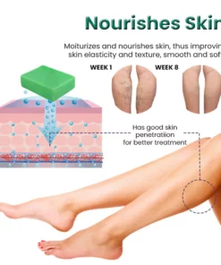 EL VITA Varicose Veins Treatment Soap