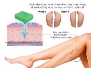 EL VITA Varicose Veins Treatment Soap