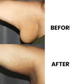 EMS Lymphatic Drainage Massage Pad