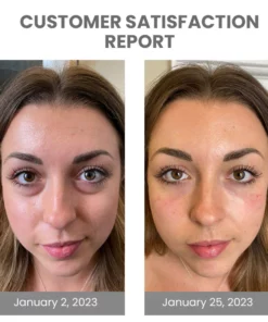 EMbelle Japan 4D Airbag Vibration Eye Massager