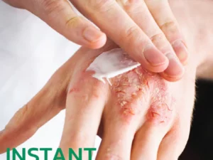 EczmoTherapy Herbal Healing Cream
