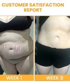 EssuraVita AntiCellulite Hip Lifting Body Oil