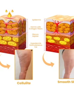 EssuraVita AntiCellulite Hip Lifting Body Oil