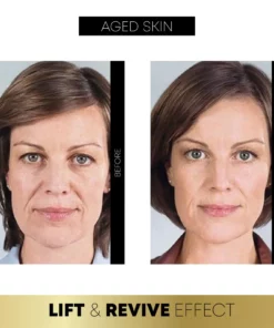 FaceSculpting Korean Protein ThreadLifting Set