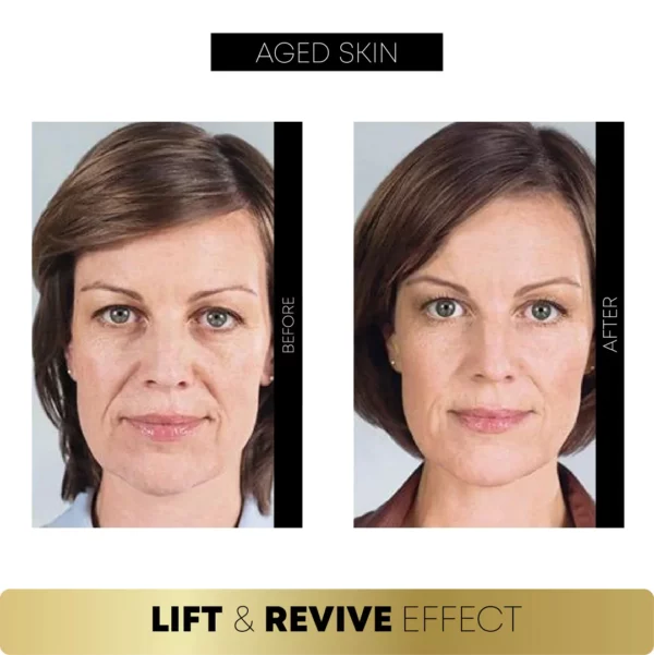 FaceSculpting Korean Protein ThreadSet de lifting