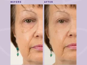 Firming Eye Cream