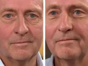 Firming Eye Cream