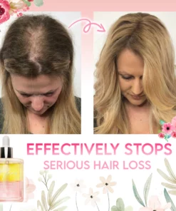 Flora Intense Growth Hair Essential Oil