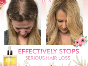 Flora Intense Growth Hair Essential Oil