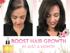 Flora Intense Growth Hair Essential Oil