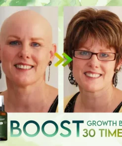 FolliBoost Hair Regrowth Spray